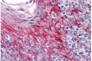 Human Tonsil: Formalin-Fixed, Paraffin-Embedded (FFPE) (ZMYM4 Antikörper  (C-Term))
