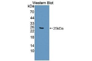 Detection of Recombinant SDHB, Mouse using Polyclonal Antibody to Succinate Dehydrogenase Complex Subunit B (SDHB)