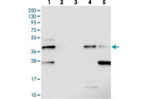 Western blot analysis of Lane 1: RT-4, Lane 2: U-251 MG, Lane 3: Human Plasma, Lane 4: Liver, Lane 5: Tonsil with C19orf66 polyclonal antibody  at 1:250-1:500 dilution. (C19ORF66 Antikörper)