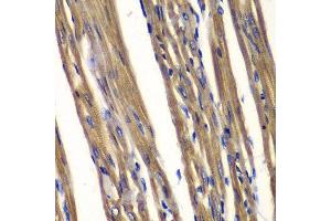 Immunohistochemistry (IHC) image for anti-Protein tyrosine Phosphatase, Non-Receptor Type 2 (PTPN2) (AA 1-353) antibody (ABIN6218927) (PTPN2 Antikörper  (AA 1-353))