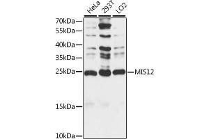 Western blot analysis of extracts of various cell lines, using MIS12 antibody (ABIN7268546) at 1:1000 dilution. (MIS12 Antikörper  (AA 1-205))