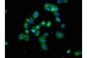 Immunofluorescence staining of HepG2 cells with ABIN7165254 at 1:100, counter-stained with DAPI. (DLK1 Antikörper  (AA 24-303))