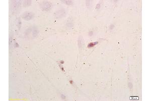 Neuroblastoma cells labeled with Anti-NSE/ENO2/? (ENO2/NSE Antikörper  (AA 201-300))