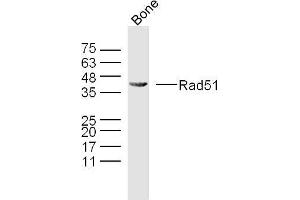 Mouse bone lysates probed with Rad51 Polyclonal Antibody, Unconjugated  at 1:300 overnight at 4˚C. (RAD51 Antikörper  (AA 81-180))