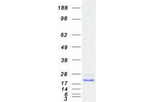 Western Blotting (WB) image for Cannabinoid Receptor Interacting Protein 1 (Cnrip1) protein (Myc-DYKDDDDK Tag) (ABIN2712915)