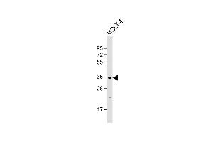 Anti-GLT6D1 Antibody (Center) at 1:2000 dilution + MOLT-4 whole cell lysate Lysates/proteins at 20 μg per lane. (GLT6D1 Antikörper  (AA 100-133))