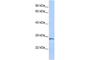 WB Suggested Anti-SFRP2 Antibody Titration: 0. (SFRP2 Antikörper  (Middle Region))