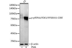 Western blot analysis of extracts of C6 cells, using Phospho-p90Rsk/RSK1/RPS6K-S380 antibody (ABIN7270036) at 1:1000 dilution. (RPS6KA1 Antikörper  (pSer380))
