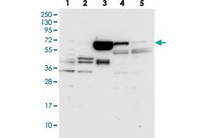Western blot analysis of Lane 1: RT-4, Lane 2: U-251 MG, Lane 3: Human Plasma, Lane 4: Liver, Lane 5: Tonsil with C12orf26 polyclonal antibody . (METTL25 Antikörper)