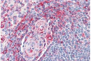 Human Spleen: Formalin-Fixed, Paraffin-Embedded (FFPE) (MVP Antikörper  (AA 1-894))