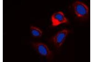 Immunofluorescent analysis of Phospholamban (pS16/T17) staining in HuvEc cells. (Phospholamban Antikörper  (N-Term, pSer16, pSer17))