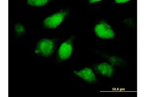 Immunofluorescence of purified MaxPab antibody to TSNAXIP1 on HeLa cell. (Tsnaxip1 Antikörper  (AA 1-366))