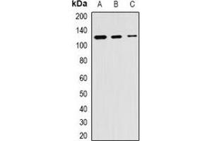 Western blot analysis of SKIV2L2 expression in Hela (A), mouse kidney (B), mouse testis (C) whole cell lysates. (MTR4 Antikörper)
