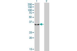 Western Blot analysis of NCR1 expression in transfected 293T cell line ( H00009437-T01 ) by NCR1 MaxPab polyclonal antibody. (NCR1 Antikörper  (AA 22-303))