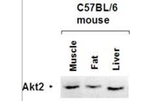 Western Blot of Rabbit anti-AKT2 antibody. (AKT2 Antikörper  (AA 455-468))