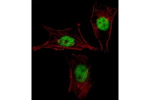 Fluorescent image of NIH-3T3 cell stained with MEOX2 Antibody . (MEOX2 Antikörper  (AA 164-192))