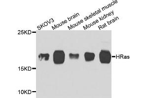 Western blot analysis of extracts of various cell lines, using HRAS antibody. (HRAS Antikörper)