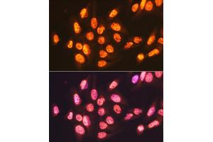 Immunofluorescence analysis of U-2 OS cells using ENT2/SLC29 Rabbit mAb (ABIN7270448) at dilution of 1:100 (40x lens). (SLC29A2 Antikörper)