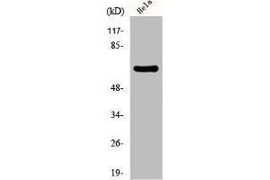 Western Blot analysis of HeLa cells using EAAT1 Polyclonal Antibody (SLC1A3 Antikörper  (C-Term))