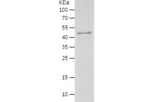 FLCN Protein (AA 364-579) (His-IF2DI Tag)