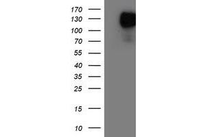 HEK293T cells were transfected with the pCMV6-ENTRY control (Left lane) or pCMV6-ENTRY ENPEP (Right lane) cDNA for 48 hrs and lysed. (ENPEP Antikörper)