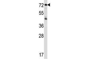 Western Blotting (WB) image for anti-Interleukin 1 Receptor, Type I (IL1R1) (AA 422-450) antibody (ABIN3031430)