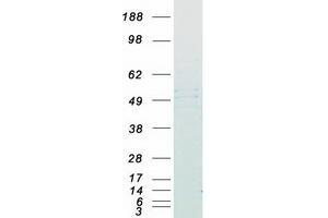 Western Blotting (WB) image for Farnesyltransferase subunit beta (FNTB) protein (Myc-DYKDDDDK Tag) (ABIN2721273)