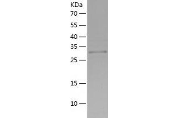 Thrombospondin 1 Protein (THBS1) (AA 19-344) (His tag)