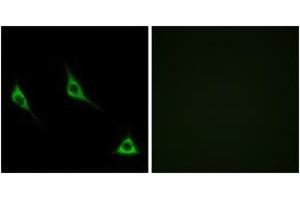 Immunofluorescence analysis of LOVO cells, using OR51A7 Antibody. (OR51A7 Antikörper  (AA 232-281))