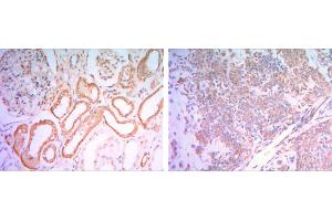 Immunohistochemical analysis of paraffin-embedded human salivary gland tissues (left) and kidney tissues (right) using HK1 mouse mAb with DAB staining.