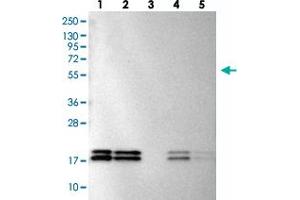Western blot analysis of Lane 1: RT-4, Lane 2: U-251 MG, Lane 3: Human Plasma, Lane 4: Liver, Lane 5: Tonsil with NME1-NME2 polyclonal antibody  at 1:100-1:250 dilution.