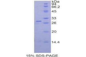 SDS-PAGE analysis of Human Renal Tumor Antigen Protein. (MOK Protein)
