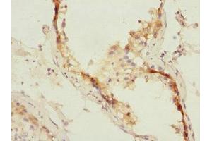 Immunohistochemistry of paraffin-embedded human testis tissue using ABIN7151071 at dilution of 1:100 (MID1 Antikörper  (AA 478-667))