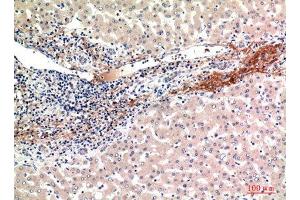 Immunohistochemistry (IHC) image for anti-Growth Factor, Augmenter of Liver Regeneration (GFER) (Internal Region) antibody (ABIN6284330)