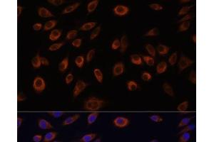 Immunofluorescence analysis of L929 cells using NTPCR Polyclonal Antibody at dilution of 1:100. (C1orf57 Antikörper)