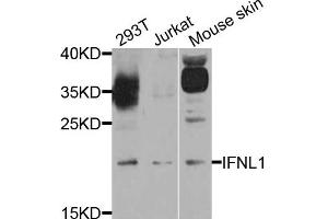 Western blot analysis of extract of various cells, using IFNL1 antibody. (IL29 Antikörper)