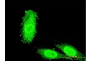 Immunofluorescence of monoclonal antibody to IRAK3 on HeLa cell. (IRAK3 Antikörper  (AA 497-596))