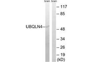 Western blot analysis of extracts from mouse brain cells, using UBQLN4 Antibody. (UBQLN4 Antikörper  (AA 201-250))