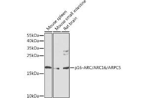 Western blot analysis of extracts of various cell lines, using p16-ARC//p16-ARC// antibody (ABIN6128967, ABIN6137131, ABIN6137132 and ABIN6224672) at 1:1000 dilution. (ARPC5 Antikörper  (AA 1-154))