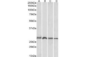 ABIN184675 (1µg/ml) staining of Mouse (A, C) and Rat (B, D) Brain (A, B) and Liver (C, D) lysates (35µg protein in RIPA buffer).