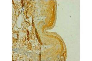Immunohistochemistry (IHC) image for anti-Casein Kinase 1, alpha 1 (CSNK1A1) (AA 2-337), (Isoform alpha) antibody (ABIN7146852)