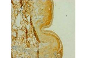 Immunohistochemistry of paraffin-embedded human skin tissue using ABIN7146852 at dilution of 1:100 (CSNK1A1 Antikörper  (Isoform alpha))
