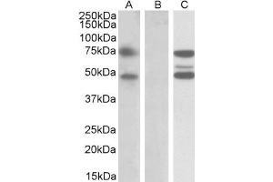 HEK293 lysate (10ug protein in RIPA buffer) overexpressing Human ASNSD1 with DYKDDDDK tag probed with ABIN5539631 (1ug/ml) in Lane A and probed with anti-DYKDDDDK Tag (1/10000) in lane C. (ASNSD1 Antikörper  (Internal Region))