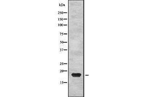 Western blot analysis of PTP4A2 using HepG2 whole cell lysates (PTP4A2 Antikörper  (Internal Region))