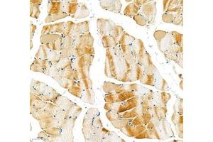 Immunohistochemistry of paraffin embedded rat skeletal muscle using Sarcomeric α Actinin (ABIN7075510) at dilution of 1:1000 (200x lens) (Sarcomeric alpha Actinin Antikörper)