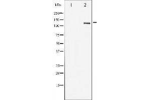 Western blot analysis of HER2 expression in 293 whole cell lysates,The lane on the left is treated with the antigen-specific peptide. (ErbB2/Her2 Antikörper  (C-Term))