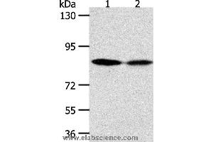 Western blot analysis of Hela and SKOV3 cell, using ADAM11 Polyclonal Antibody at dilution of 1:500 (ADAM11 Antikörper)