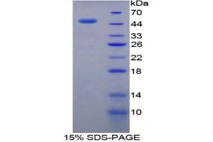 SDS-PAGE (SDS) image for Retinoblastoma 1 (RB1) (AA 639-778) protein (His tag,GST tag) (ABIN1525573) (Retinoblastoma 1 Protein (RB1) (AA 639-778) (His tag,GST tag))