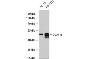 Western blot analysis of extracts of various cell lines, using DC antibody (ABIN6130928, ABIN6139428, ABIN6139429 and ABIN6217129) at 1:3000 dilution. (DCAF13 Antikörper  (AA 298-597))