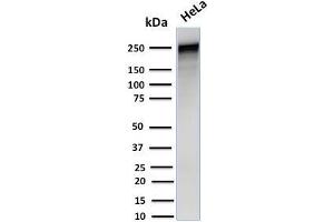 Western Blot Analysis of Human HeLa cell lysate using Spectrin alpha 1 Mouse Monoclonal Antibody (SPTA1/1832). (SPTA1 Antikörper  (AA 356-475))